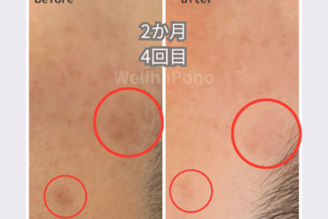 【札幌】乾燥・くすみ・小ジワ対策に◎FAITHブライトムースセラム｜寝ている間に“美白×保湿”の泡パック美容