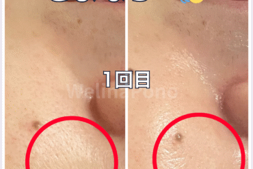 毛穴・シワ・乾燥・くすみの根本改善に。ツヤ肌フェイシャルキャンペーン中