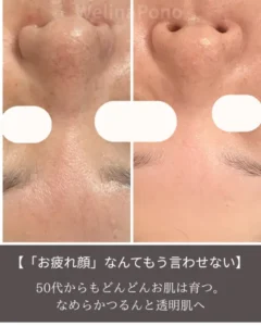 毛穴もしわもくすみも改善。なめらか美肌へ。