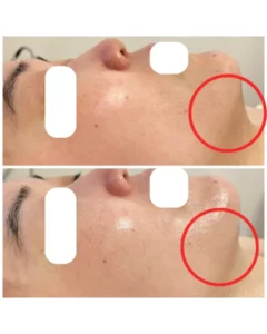 度で変わる。でも、目的は「肌を育てる」こと。／ 40代の表情筋ケア・EMSリフトアップ