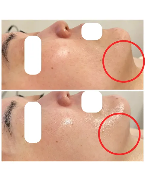 度で変わる。でも、目的は「肌を育てる」こと。/ 40代の表情筋ケア・EMSリフトアップ