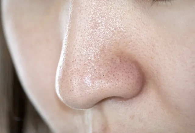 なぜ吸引しても黒ずむの？プロが教える「毛穴レス」への近道