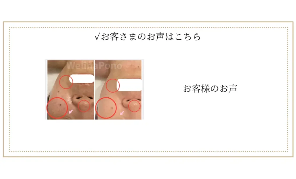 お客様の声はこちら
